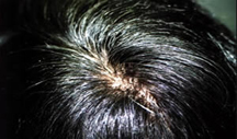 tophead